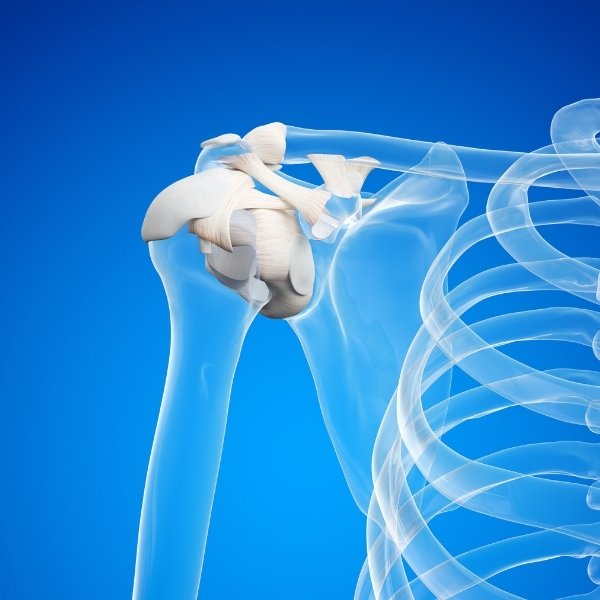 Lesión de Labrum